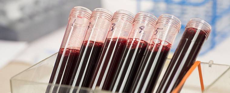 Neutrophil Labs HNA Nomenclature Image
